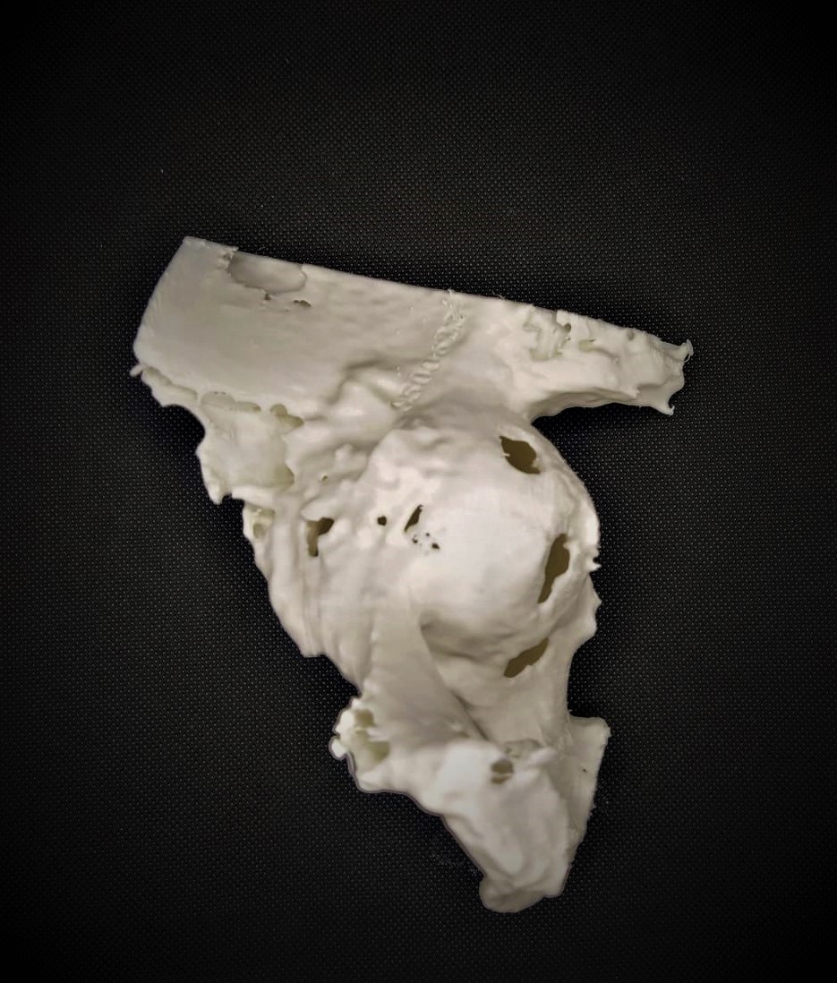 FabLab 3D Hospital Marañón tweet media