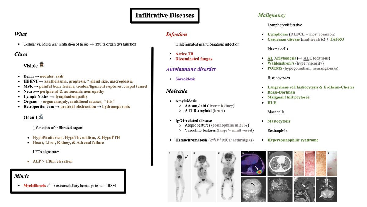 🏁 That's it for my whirlwind tour of some major Infiltrative Diseases! - Summary: 🏁 Suspicion for Infiltrative Disease may be prompted by 'Visible' clues (on exam/imaging) or 'Occult' clues (on labs/syndrome assessment) 🏁 Organ predilection varies by disease type