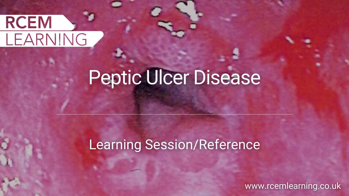 The nature of peptic ulcer disease (PUD) is changing. Today's session is an up-to-date review of PUD pathophysiology, presentation, management and complications in the ED @CW_EM_ICM @rajeshchatha @AFrankEM LS🔒Members➡️ ow.ly/QEcQ50IYWnN Ref🆓👉 ow.ly/ntGy50IYWnM