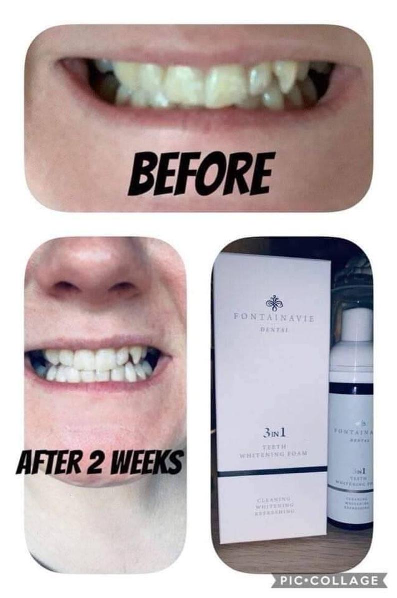 😁Our Top Sell Out Product😁

Our amazing 3 in 1 teeth whitening foam! 

‼️EXTREMELY EFFICIENT – LASTS UP TO 4 MONTHS
‼️EFFECTS VISIBLE AFTER 1-3 WEEKS OF USE

Payments upfront secures your order!!
Post available.

I predict another sell out!!!!😍😍😍