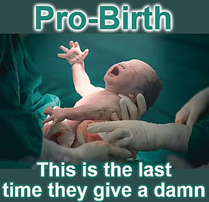 CalameDiana's tweet image. #probirthnotprolife Big difference