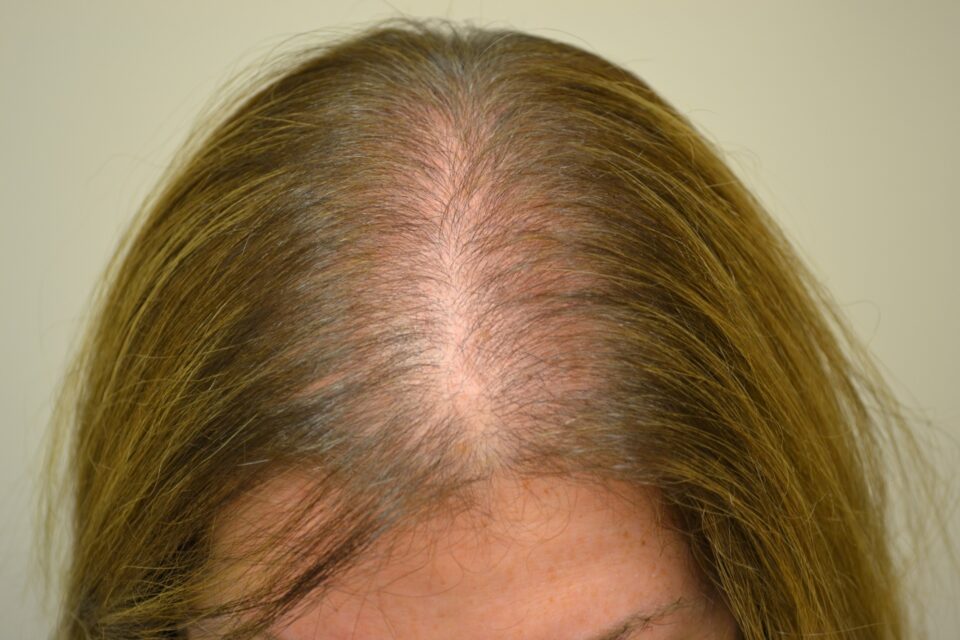 zazoomblog's tweet image. Olio di rosmarino: contrasta la caduta e diradamento dei capelli - #rosmarino: #contrasta #caduta zazoom.it/2022-05-04/oli…