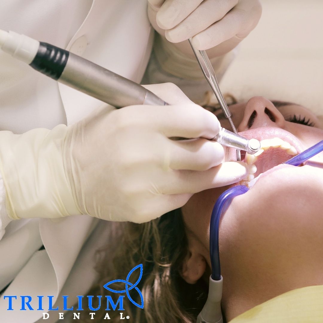 A lot of adults and children grind their teeth at night without even realizing it. Protect your smile with a sleep guard against teeth grinding! See your local Trillium Dental for more information. 

#canada #dentist #oralhealthcare