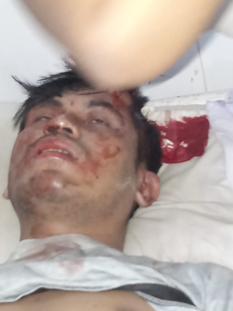 Young MBBS doctor doing rural service almost beaten to death by mob in Tripura. @Himalayanmuse <a href="/IMAIndiaOrg/">Indian Medical Association</a> <a href="/FAIMA_INDIA_/">FAIMA Doctors Association</a>