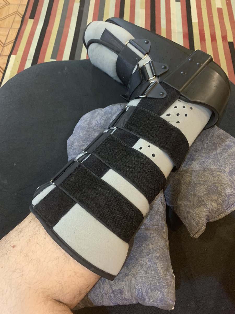 Marcelo23139584's tweet photo. @melhortardeband sou diabético tipo 2 e atualmente com um pé charcot . Tem algo q posso fazer pra melhor ? #MelhorDaTarde #mdtsim #diabetico https://t.co/vUpORRo9jR
