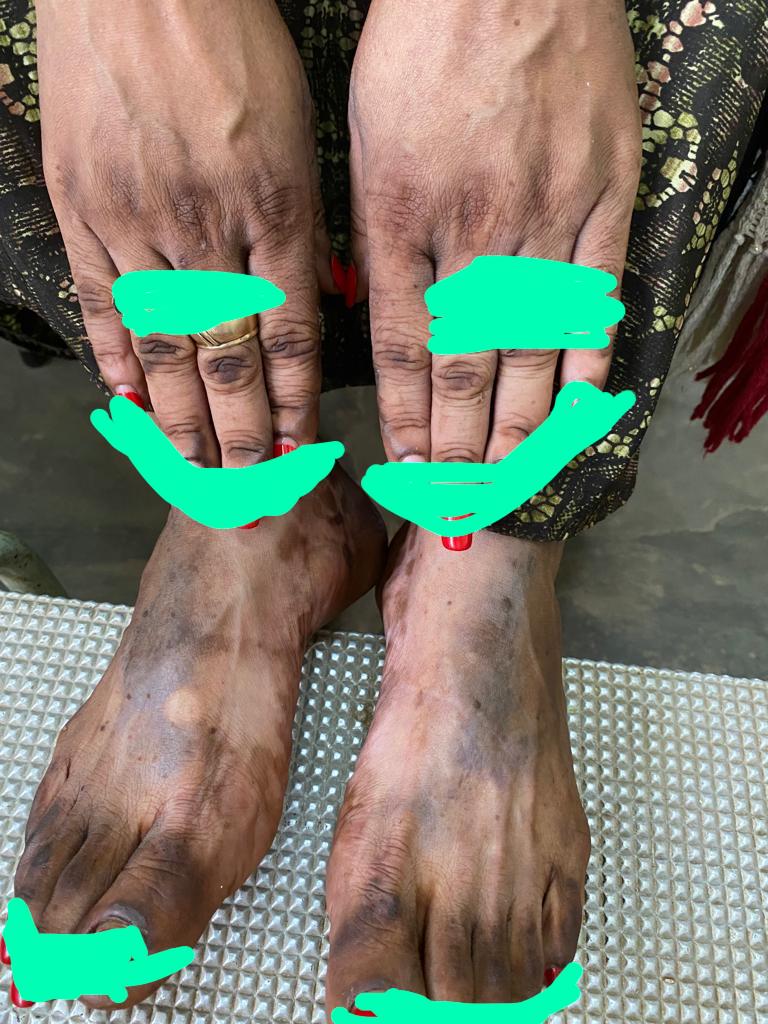 University Teaching Hospital of Kigali/CHUK on Twitter "Dermatologist