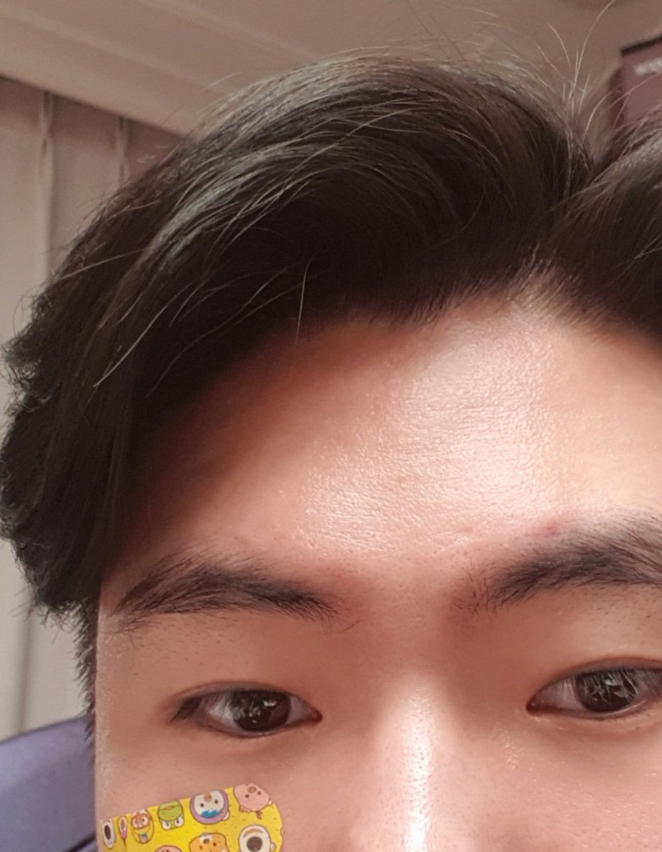 우리 조카 너무 귀엽네 진짜 이제 2살 된 꼬맹이가 오도도 달려와서 얼굴에 밴드 붙여주는데 심쿵당해버렸다