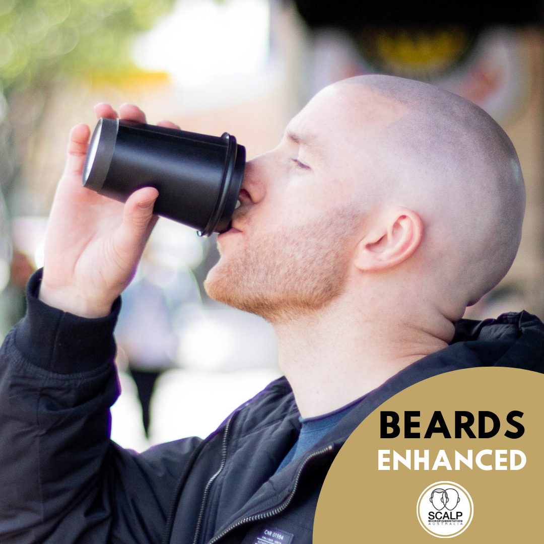 SMP_Australia's tweet photo. Have you got a patchy beard or wish to make it look thicker and darker? Wish to have the look of soft stubble? 

⚠️Caitlin in our Adelaide location specialises in this advanced technique that she has developed over the last 4 years. 

⚠️With her original results holding w https://t.co/ZGExY6rYCC