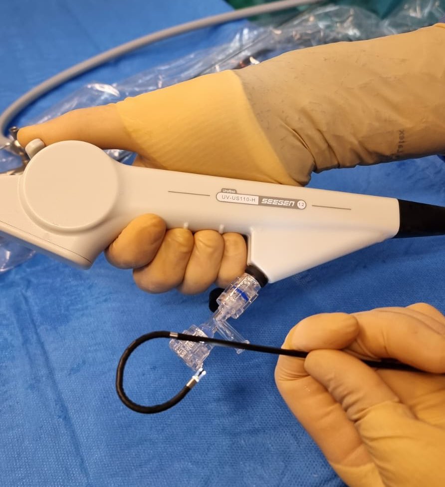 sergiofumero's tweet photo. Muy buenas sensaciones con el URSflex single-use Urofino de Seegen @Presurgy, (7.5F) Excelente visión, maniobrabilidad y tacto. https://t.co/BAk2qAvg8i
