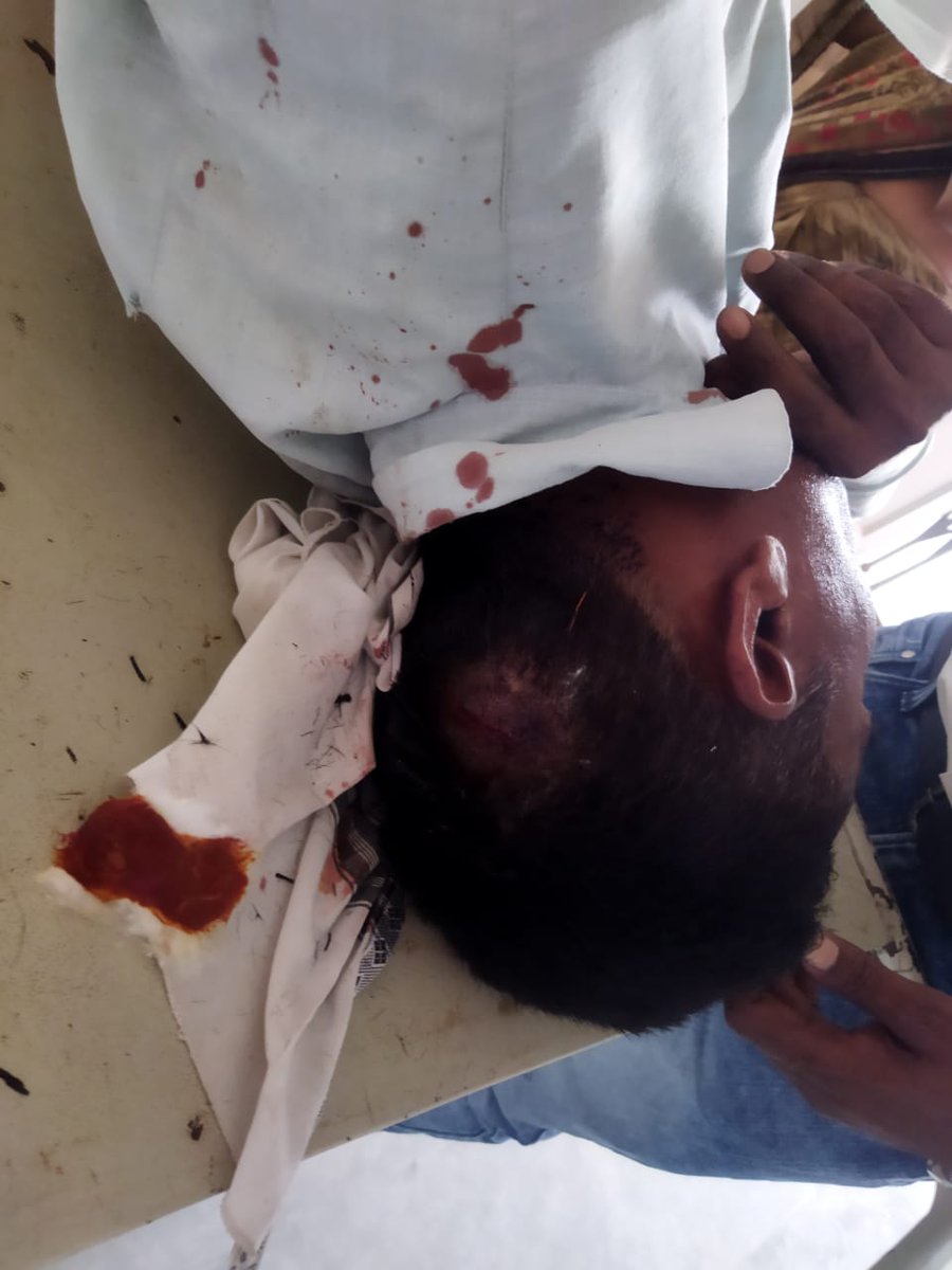 थाना जगनेर मैं विद्युत कर्मचारियों के साथ हुई मारपीट की घटना अत्यंत निंदनीय है <a href="/agrapolice/">POLICE COMMISSIONERATE AGRA</a> आरोपियों को तत्काल गिरफ्तार कर अग्रिम कार्रवाई करें ऊर्जा प्रबंधन एवं सरकार से अनुरोध है कि जल्द से जल्द विद्युत कर्मचारियों एवं संपत्ति सुरक्षा कानून को लागू कराने का प्रयास करें <a href="/dgpup/">DGP UP</a>