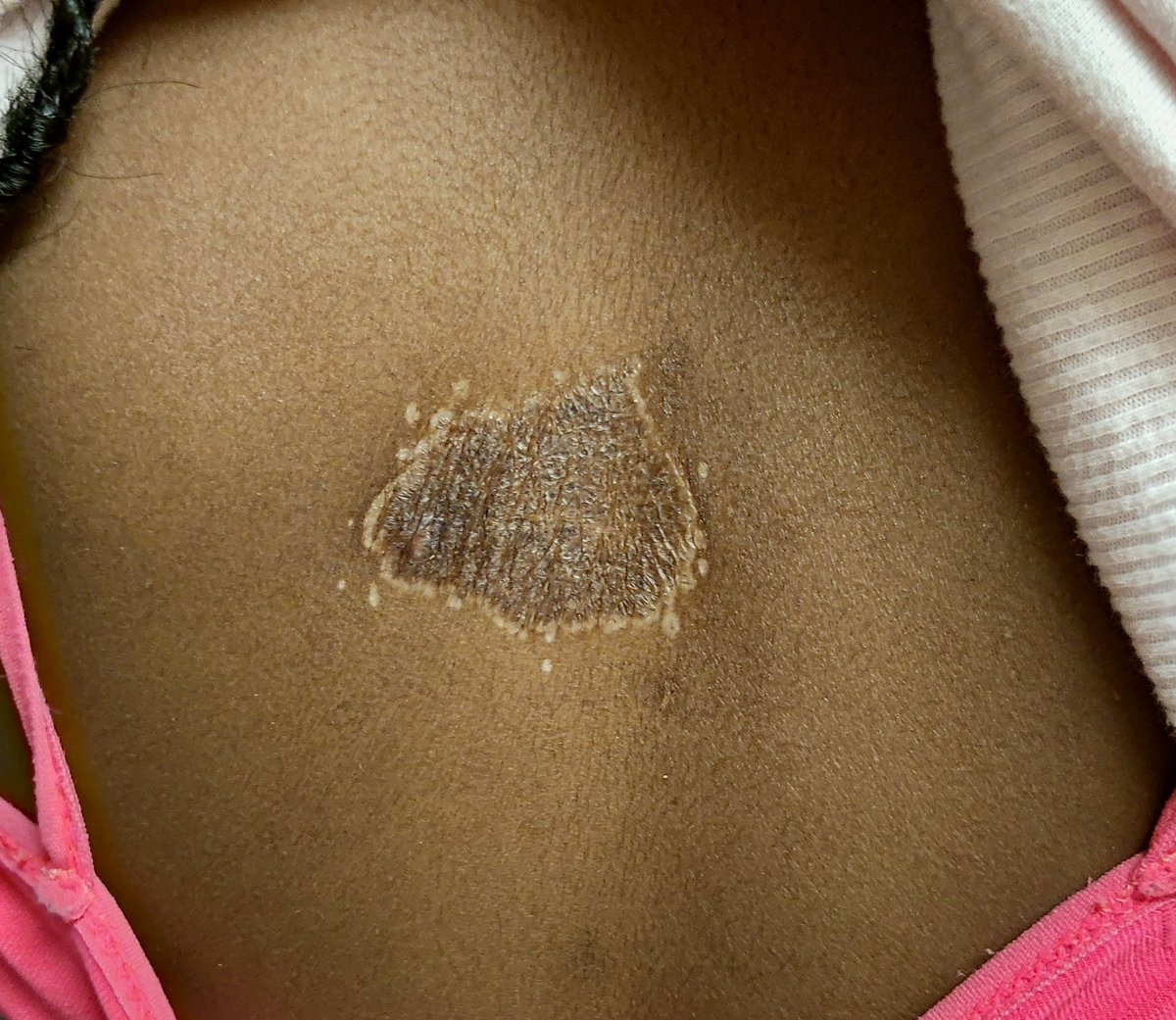 Dermnemonics tweet media