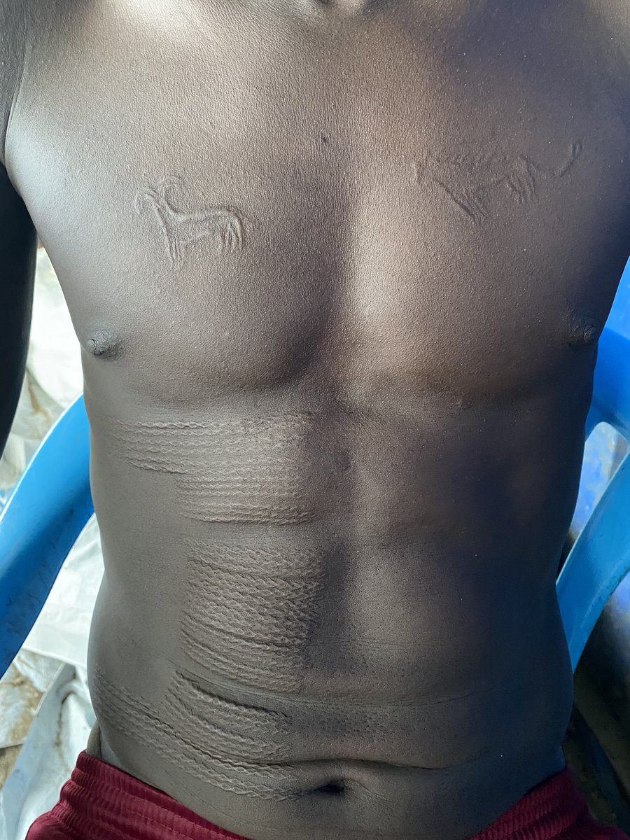 MurleHeritageSS's tweet photo. #Murle #youth from Lanngo ageset in #Pibor #SouthSudan do meaningful #scarifications of their ageset colours & animals & the qualities they represent. For Lanngo it’s yellow- kob, lion, fish patterns and dry grass below. V significant identity markers and symbolic of aspirations https://t.co/shNJEurQ7N