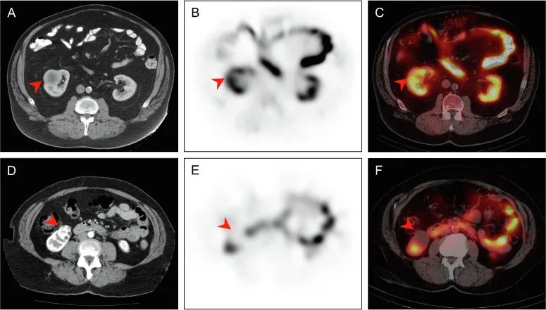 European Urology tweet media
