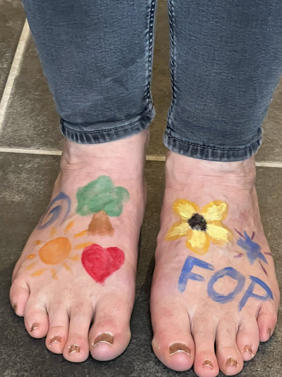 JudeBubbear's tweet photo. #FunFeet4FOP #FOPAwareness one of the first signs of FOP is that children are born with malformed big toes https://t.co/0mZFgYj5YH