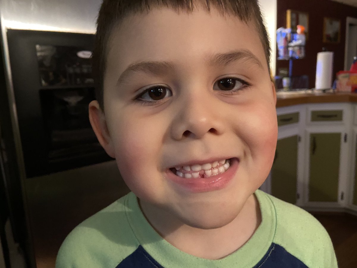 larysamarie's tweet photo. My baby isn’t a baby!!! He lost his first tooth this morning🦷🧚‍♀️ @hawkchica https://t.co/GuTyYwutkX