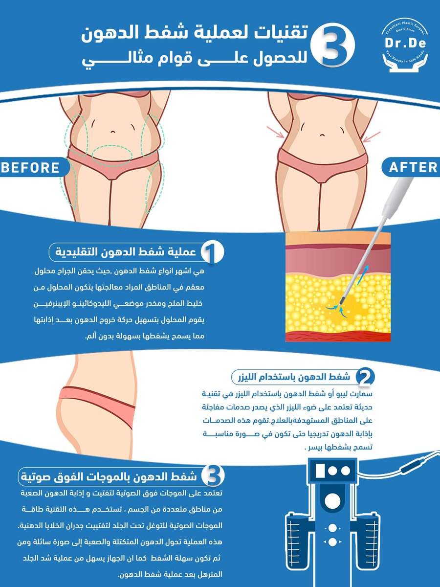 drdiaaothman's tweet photo. أهم تقنيات عملية شفط الدهون للحصول على القوام المثالي سواء أكانت العملية تقليدية أو باستخدام الليزر أو بالموجات الفوق صوتية.
#الدكتور_ضياء_عثمان
#DrDe https://t.co/sC0p9u6TEE