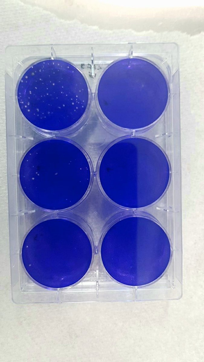 Plaque assay is one of the most accurate methods for  quantification of infectious virons. It would be challenging to plaque viable airborne viruses. Some useful tips:jove.com/video/52065. The plate is for the airborne influenza sample collected after 45min aerosol aging time.