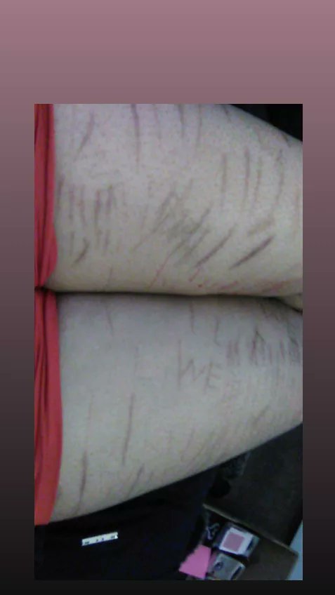 Ursock2's tweet photo. April 23 body check I'm inviting fat phobia  ughh my legs are massive #edtwt #bodycheck #fatphobia #fatspo https://t.co/DlR7SlpoLJ