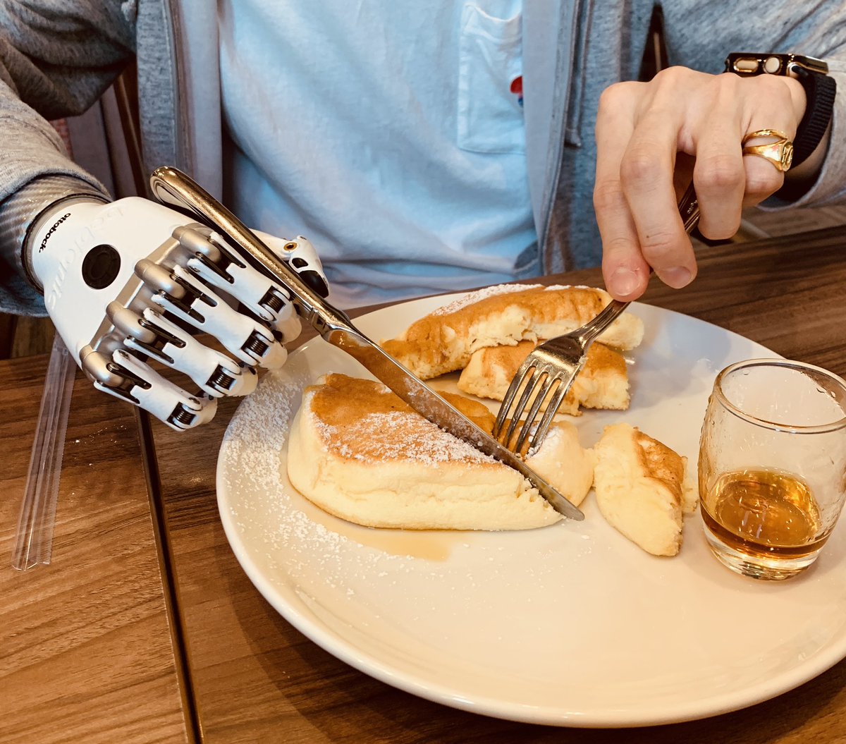 CyanKuni's tweet image. 日本でこれをやってる人は超少ない。

でも、これはやりにくい…。
ナイフがズレるのをなんとかできればもっとやりやすくなる。

#義手 #筋電義手 #bebionic3 #手 #右手
#親指 #人差し指 #中指 #薬指 #小指