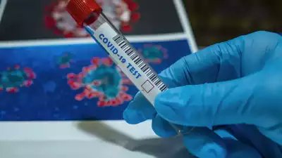 timesofindia's tweet photo. Covid R-value crosses 2 in Delhi: IIT study 

Read: https://t.co/gZA654Vy6v https://t.co/LvT6IrgVUH
