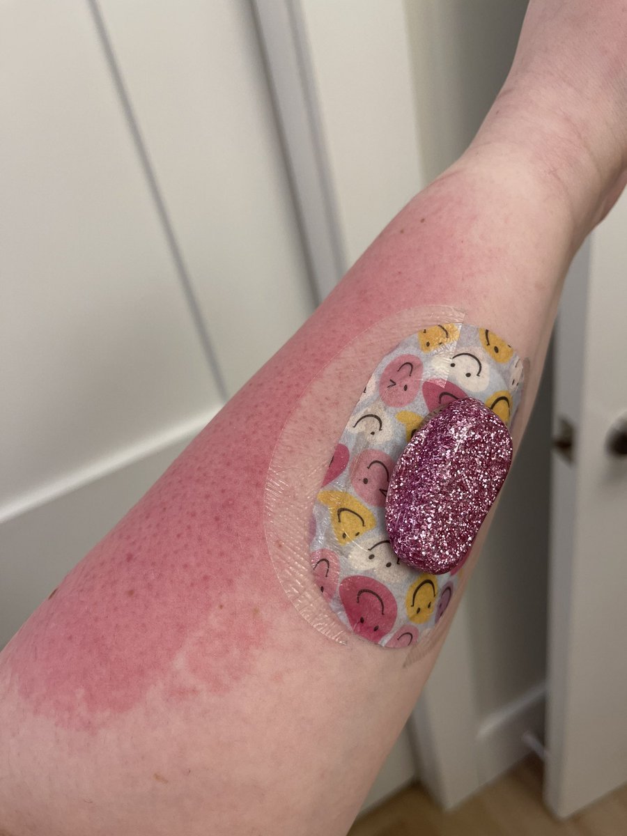 TypeOneChic's tweet image. Don’t forget your sunscreen 😭