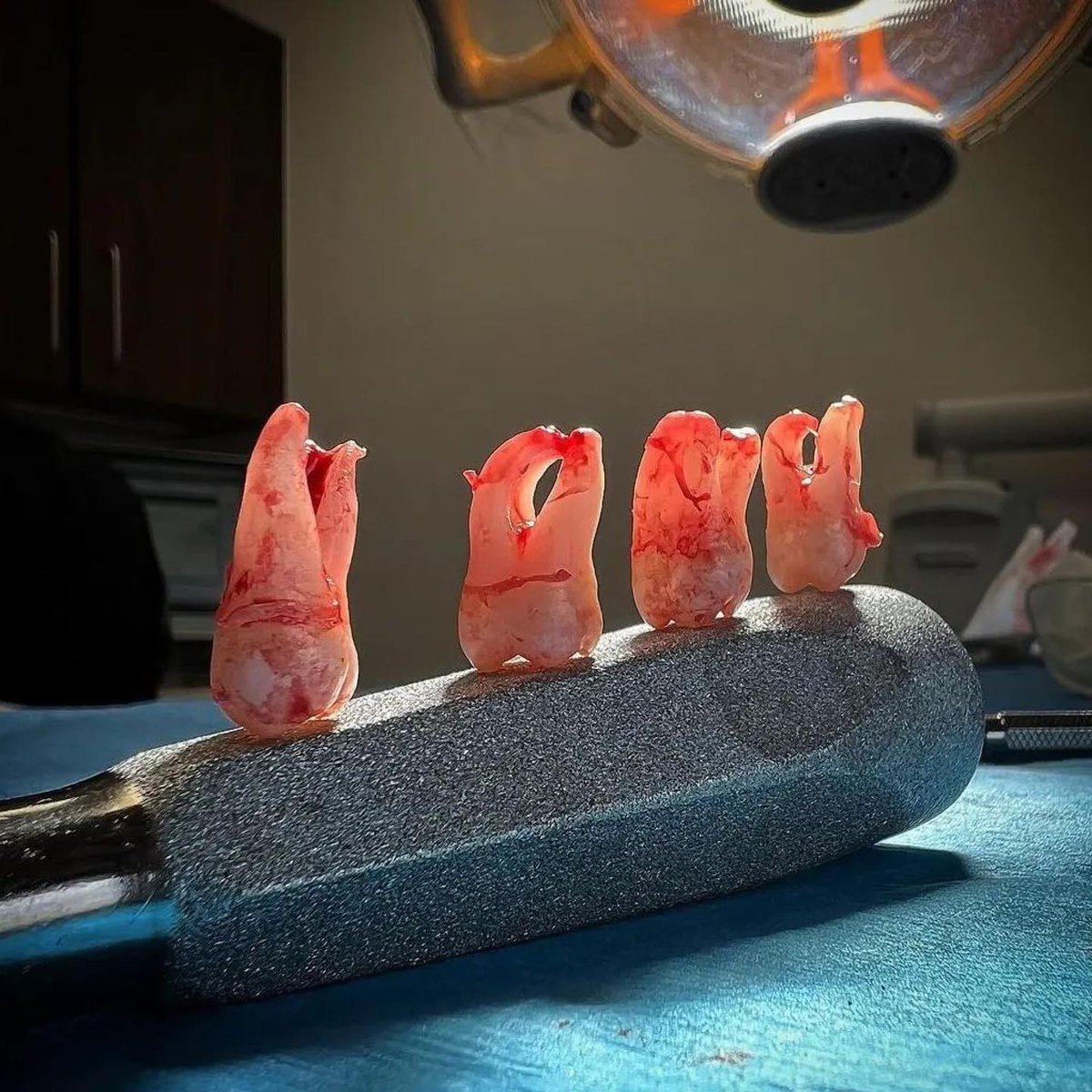Modern dental approaches offer painless methods