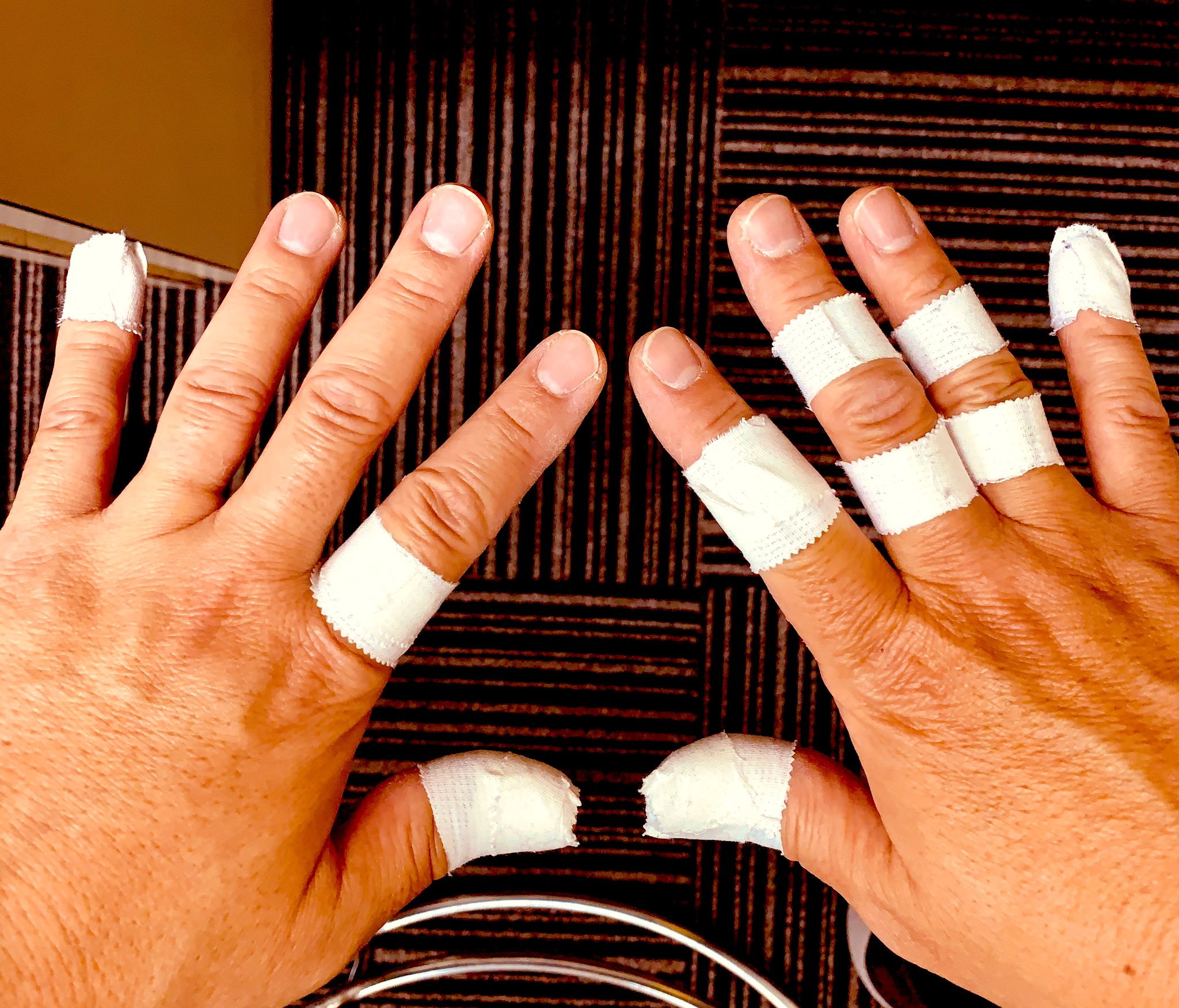 吉田太郎 The Alfee仙台コンサート これからドラム叩きます バレーボールではありません Thealfee 仙台サンプラザホール テーピングまみれ T Co Ndrswexkzb Twitter