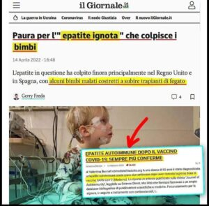 Epatite: il rapporto col mRNA sospettato già nel 2021.
Epatite autoimmune in via di sviluppo dopo il vaccino contro la malattia di coronavirus 2019 (COVID-19): causalità o INCIDENTE...?