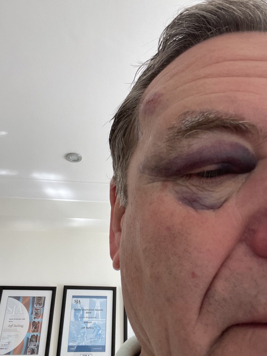 JeffStelling's tweet image. Like Tyson Fury I have decided to give up boxing !