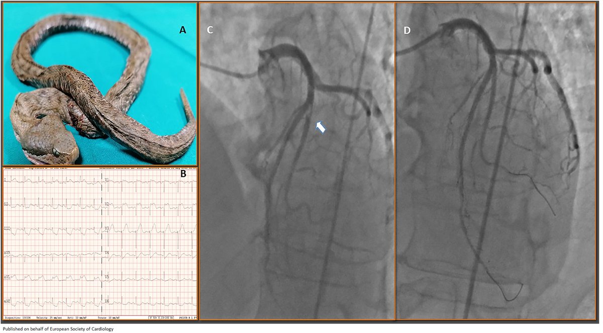 European Society of Cardiology Journals tweet media