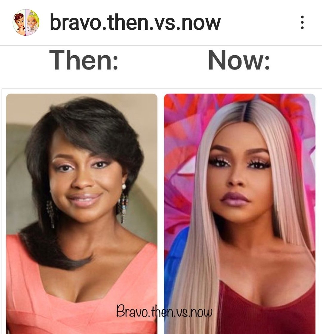 restingbfacexo's tweet photo. Whoahhhhh! Her after pic looks nothing like the Phaedra I saw on TV. What do you think she's had done?
#RHOA https://t.co/6RUgViVkNP
