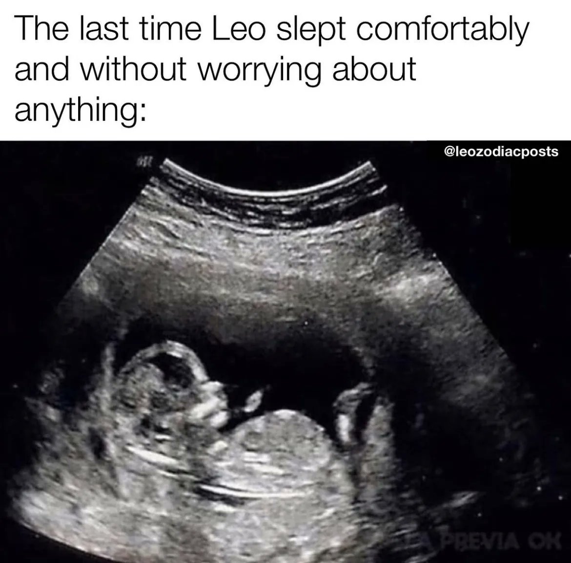 Leo_Tweets's tweet photo. #Leo facts 👏🏼 https://t.co/EYYFcB2MsN