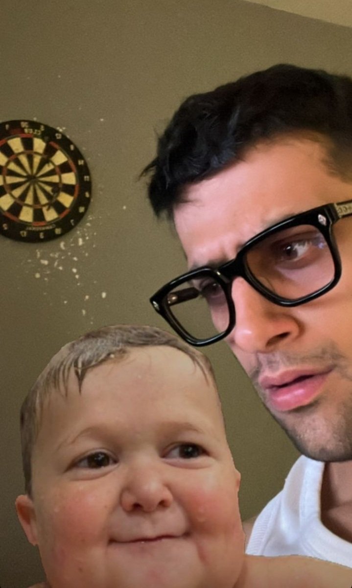 Reynmen spidermana dönüşüyor izle gör mucizeyi
@akareynmen