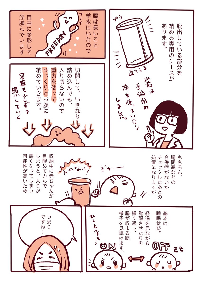 産前に腹壁破裂という症状が見つかったおはなし。②(1/2) 