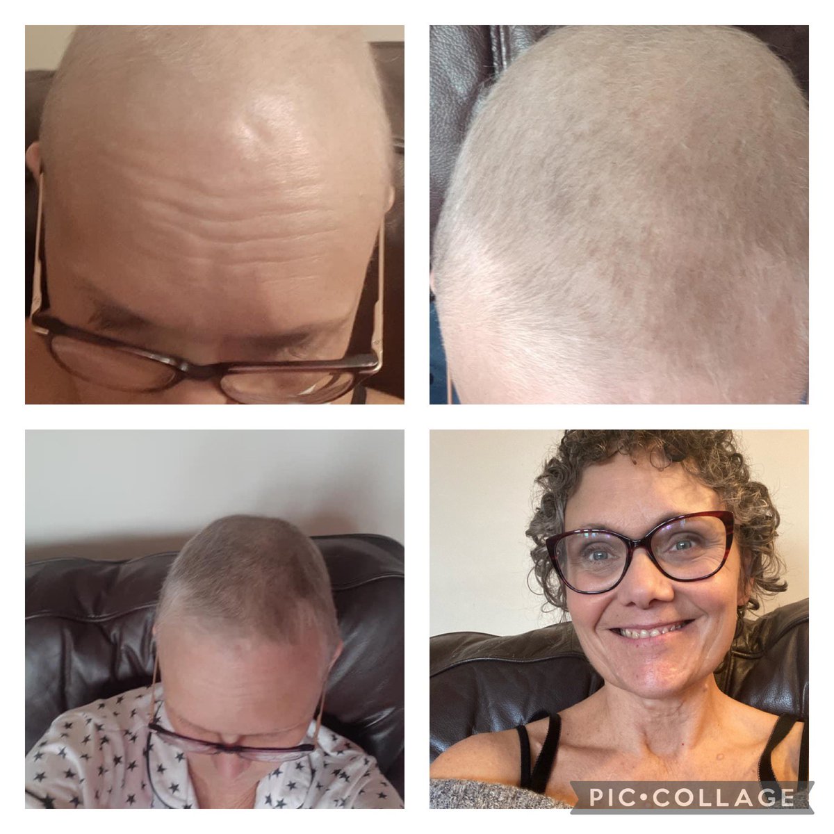 sunnyflower20's tweet photo. It’s my cancerversity 3 years since I discovered another lump in my right breast . This meant 2nd breast cancer! I’d only turned 50 in 2018 and this was a massive shock . Very unusual . Please check you bumps for lumps regularly! #Cancer #BreastCancer #checkyourbumpsforlumps https://t.co/jSmZRi0evh