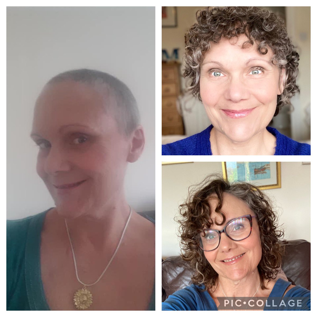 sunnyflower20's tweet photo. It’s my cancerversity 3 years since I discovered another lump in my right breast . This meant 2nd breast cancer! I’d only turned 50 in 2018 and this was a massive shock . Very unusual . Please check you bumps for lumps regularly! #Cancer #BreastCancer #checkyourbumpsforlumps https://t.co/jSmZRi0evh