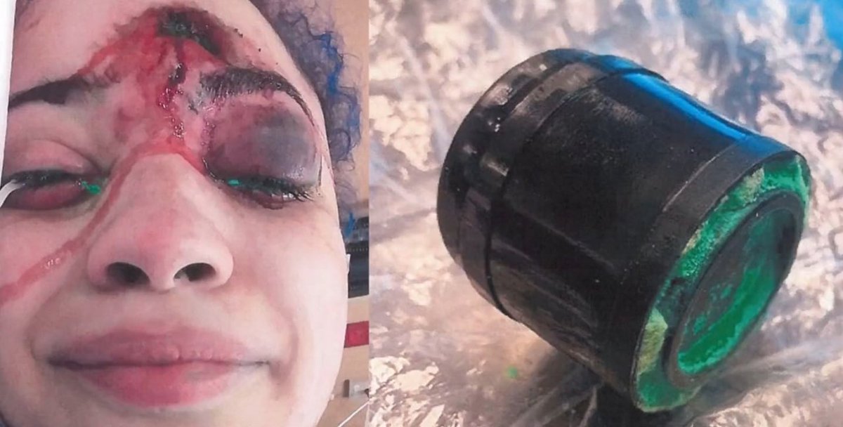 vic_gaz's tweet image. Our Anzacs gave their lives for our freedom, this freedom was taken away from us over the last 2+ years due to everyone on the National Cabinet

Some lost jobs, discriminated against and in VIC faced violence for not getting or supporting vax mandates etc.

Did they die for this?