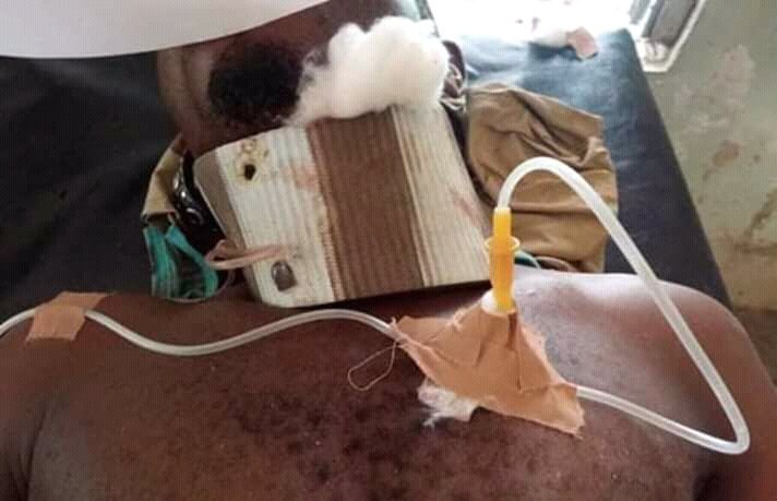 Meet Dr. Chibuike Chukwudum

His carton improvised incubator saved a premature new born from death, no modern incubator in the hospital. 

He also used slippers to make a cervical collar to save an accident victim from choking to death. Both are alive today.

RT to celebrate him