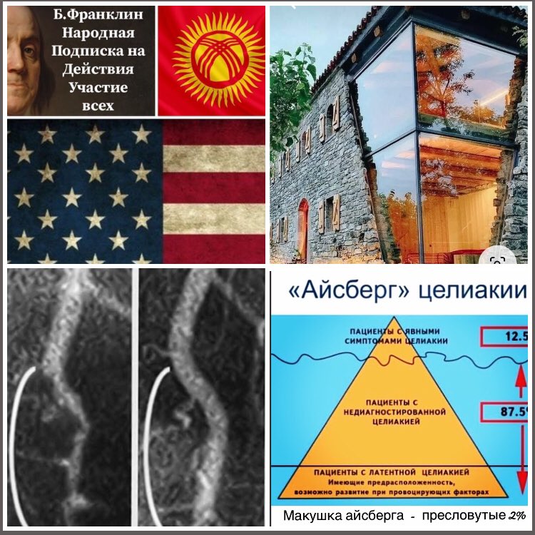 rainermar65's tweet photo. @tikenekmedia @akeneev А что вы сделали для того, чтобы дети были увлечены другими вещами.
Есть мой СТАРТАП  для Кыргызстана - медицинский и образовательный с организацией тысяч рабочих мест.
ПОДДЕРЖИТЕ. ЭГОИЗМУ НЕТ. https://t.co/R6PzFZR8cX
