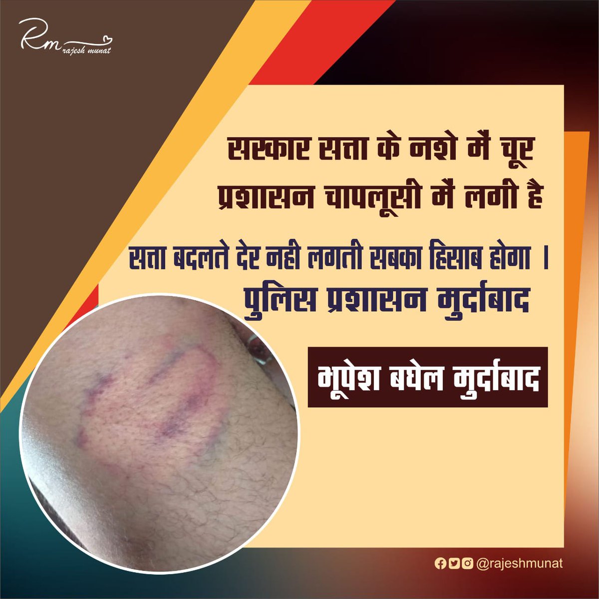 #निर्दोष_विद्युत_संविदा_कर्मचारियों_को_जेल_से_रिहा_करें_छ०ग०सरकार
#CG_With_विद्युतसंविदा_कर्मचारी_संघ
#लोकतंत्र_की_हत्या  #न्याय_दो_न्याय_दो
<a href="/bhupeshbaghel/">Bhupesh Baghel</a> 
<a href="/BJP4CGState/">BJP Chhattisgarh</a> 
<a href="/INCChhattisgarh/">INC Chhattisgarh</a> 
<a href="/gyanendrat1/">Gyanendra Tiwari (Vistaar News)</a>
<a href="/CspdclOfficial/">CSPDCL</a> 
<a href="/AAPChhattisgarh/">AAP Chhattisgarh</a> 
<a href="/BhimArmyChief/">Chandra Shekhar Aazad</a>