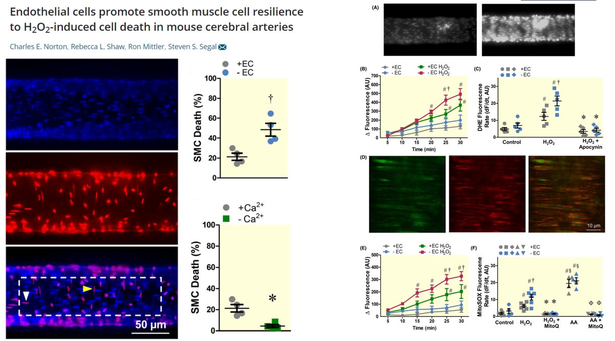 Endothelium protects #SmoothMuscleCell from H2O2-induced, caspase-/Ca2+-dependent Death in pressurized🐭#PosteriorCerebralArtery

EC-derived cytoprotective factor for SMC?
NOT #GapJunction #CarbonMonoxide #NitricOxide

Dr Steven Segal lab Acta Physiol 2022
onlinelibrary.wiley.com/doi/10.1111/ap…