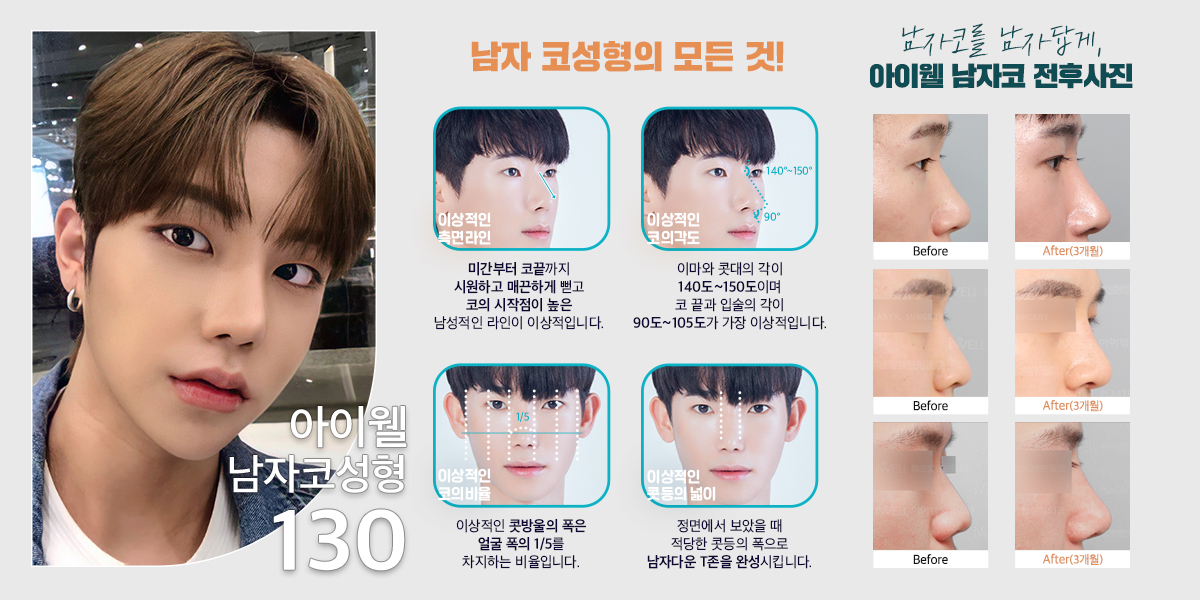 아이웰성형외과 on Twitter: 아이웰성형외과 On Twitter: