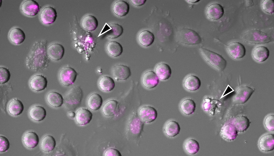 ICR_London's tweet photo. 🧬 It's #DNADay!

More than 60 years ago, we provided the first conclusive evidence that the fundamental cause of #Cancer is damage to our #DNA.  Now, our scientists are exploiting the DNA damage response against cancer.

Read more 👇
https://t.co/B2dmEt8XNQ https://t.co/FDAPyrm3Oc