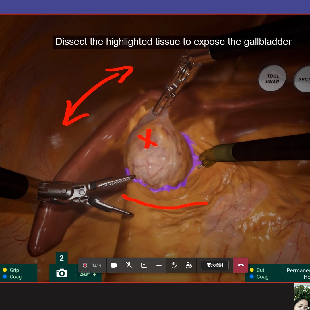 YoungTah1948's tweet image. 保持與原廠的聯繫，確實做教育訓練也是我們的日常
メーカーさんとのリモートトレーニング

#SurgicalScience #Simbionix #3DSystem #RoboticSurgery #MedTech #MedEd #MedTwitter #simulation #IAmFullyPrepped #simulator #MedTraining 
#永達儀器 #您醫護教育的好朋友 #YTSimulator
#コツコツ #医学