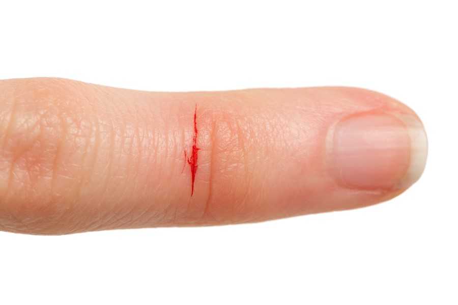 janssenleader's tweet photo. DEATH BY 1,000 CUTS 
KILLS MORE CULTURES
THAN A FATAL BLOW:
🩸 showing up late
🩸 taking plays off
🩸 sloppy practices
🩸 poor execution
🩸 skipping reps
🩸 grumbling about roles/PT
🩸 eye-rolling when coach talks
🩸 not holding people accountable
#CutsKill
#CultureWins https://t.co/DMTbex2p28