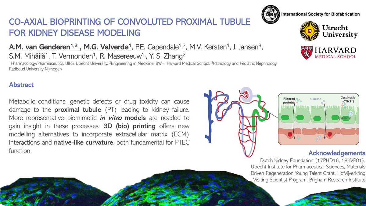 AnneMetje's tweet photo. Excited to present our poster for #Biofab2022 @ISBioFab on using co-axial printing to create convoluted hollow microfibers that better mimic the physiology of the proximal tubule for kidney disease modelling. Read more in our poster below! @ShrikeZhang @TVermonden @SilviaMMihaila https://t.co/TlF84CaXch
