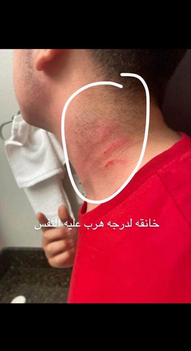 aya_hraisha's tweet photo. اني في حالة صدمة من الي قريته الحق. هدا طالب متاعي السنة الفاتت قمة في الادب و شاطر ماشاءلله. شن ممكن يكون السبب الي يخلي مدير المدرسة الي هو مفروض اكثر واحد حريص عليهم لانهم امانة عنده الصغار يدير حاجة زي هادي. مصدومة في المدرسة اني المشكلة نعرفهم شخصيا. https://t.co/Q0ww5BTuzQ