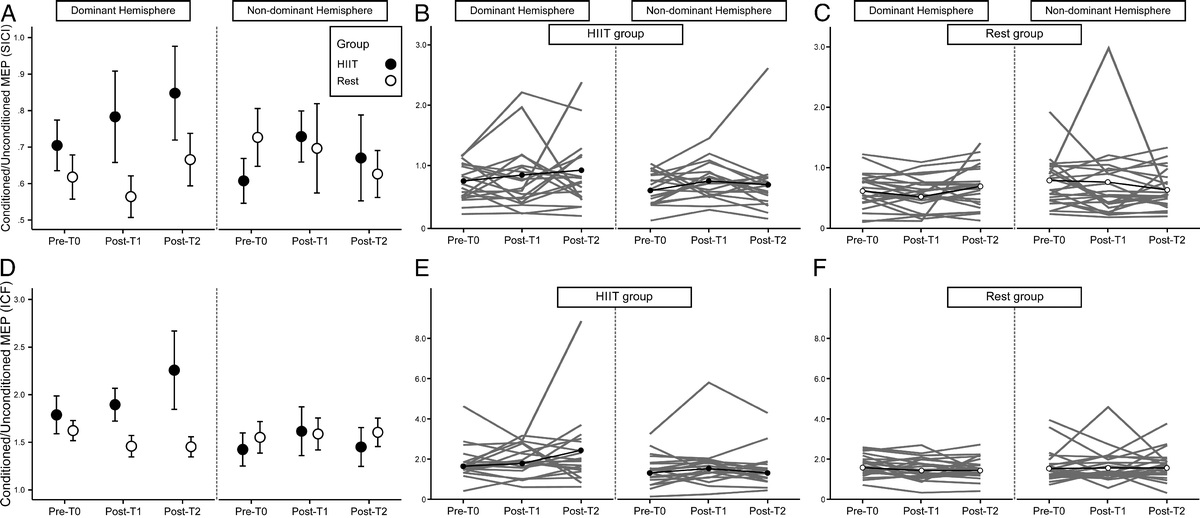 Acute High-Intensity Interval Exercise Modulates Corticospinal Excitability in Older Adults

ow.ly/mjKA50IR8LB