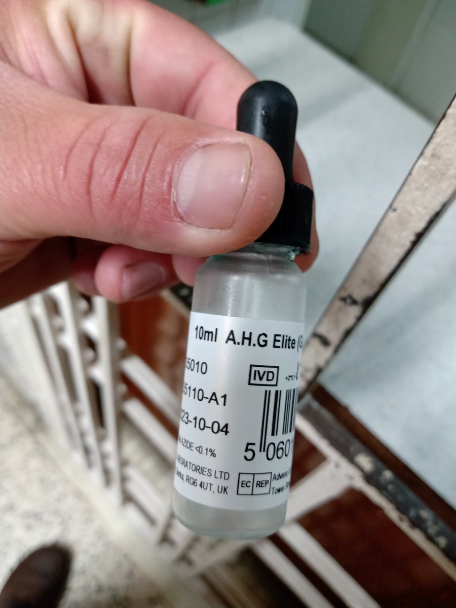 rinconjja's tweet photo. @NicolasMaduro Sr presidente. En el hospital de Mérida, en banco de sangre. No hay reactivo de vital importancia https://t.co/GD8YHKm8sJ