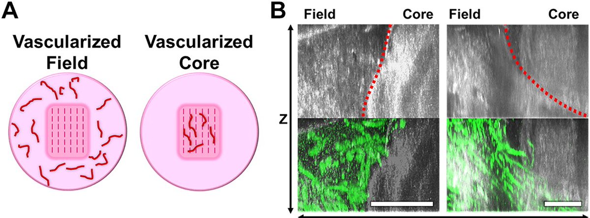 ajpheartcirc's tweet photo. New method aligning 3D collagen scaffolds embedded with #microvessel fragments to different levels of #anisotropy addresses gaps in #TissueEngineering by supporting inclusion of large multicellular structures in pre-aligned constructs https://t.co/jUC4ySkfFX
@uusci @UtahBME https://t.co/dvra9IZF6x